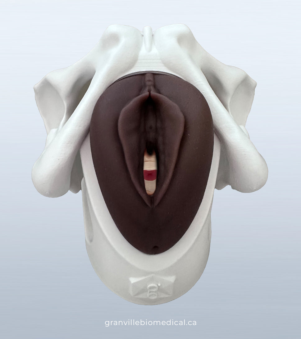 Iris Pessary and Device Demonstration Model