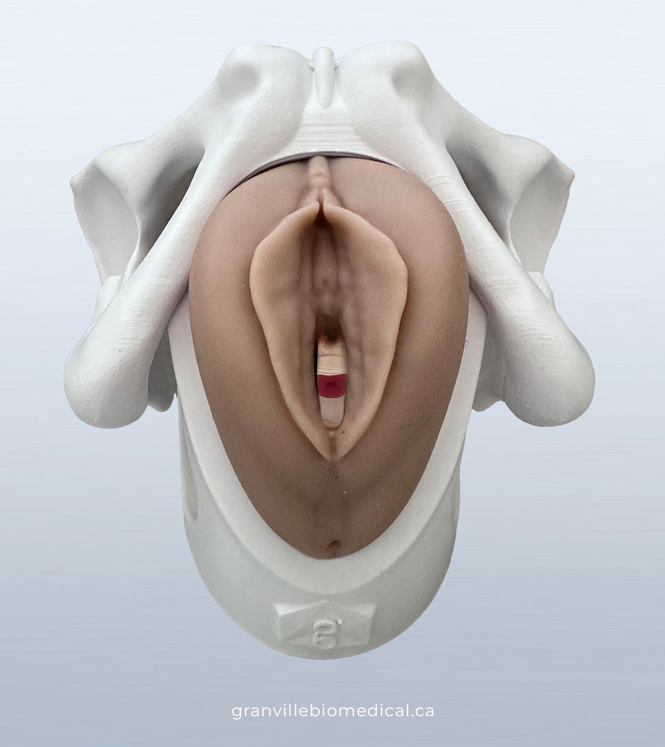 Iris Pessary and Device Demonstration Model