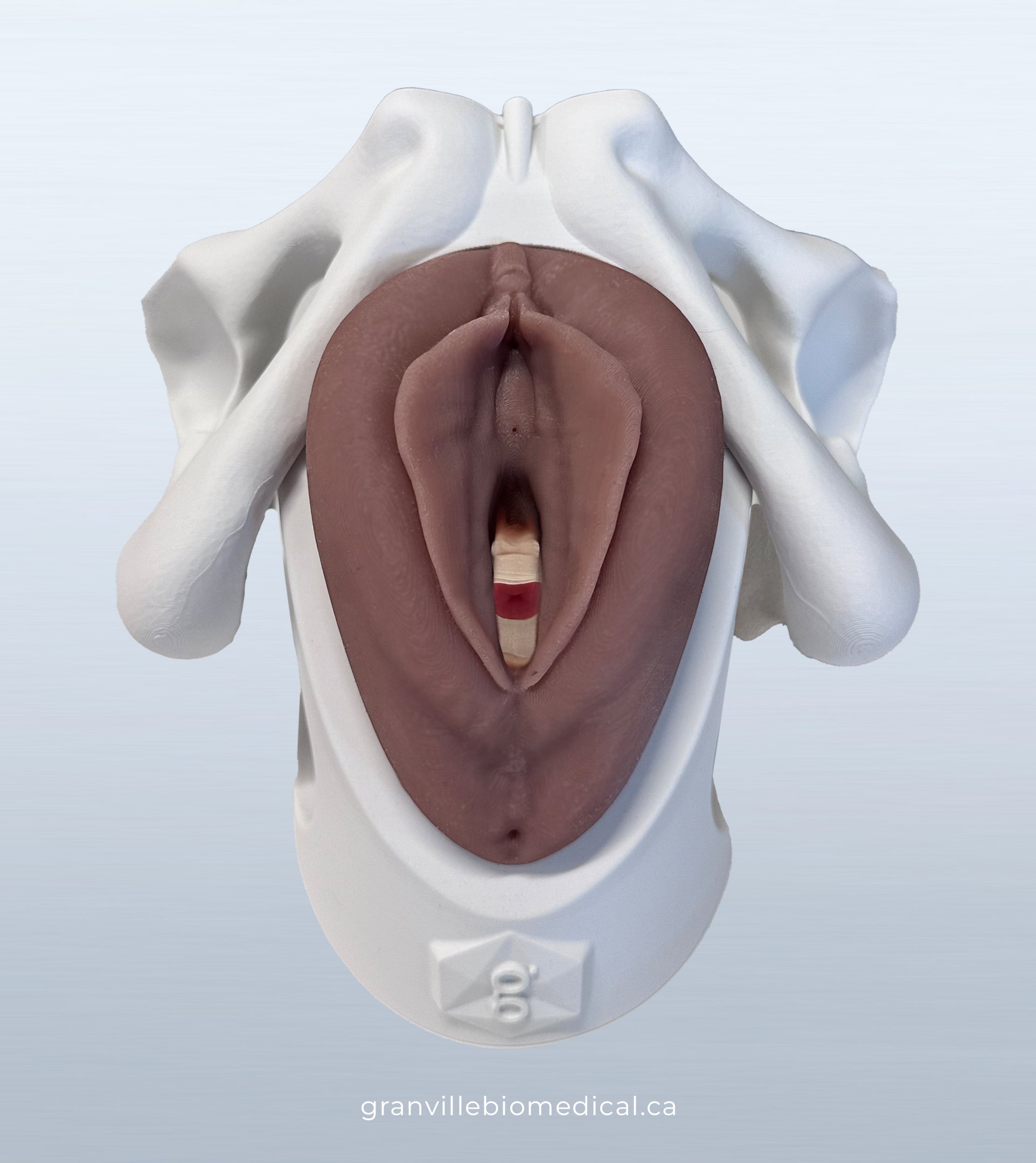 Iris Pessary and Device Demonstration Model