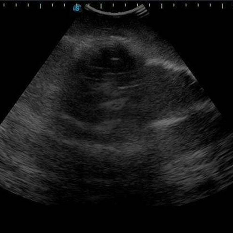 Recognition of landmarks by ultrasound and image interpretation