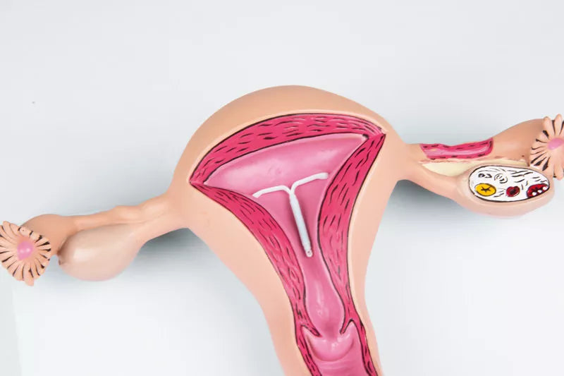 Uterus Model
