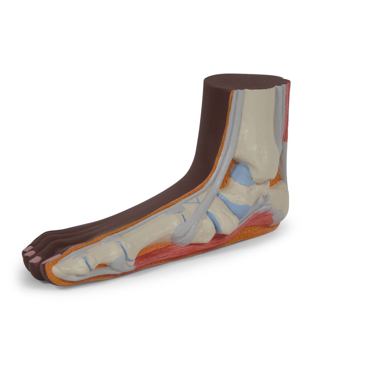 Flat Foot Model (Pes Planus)