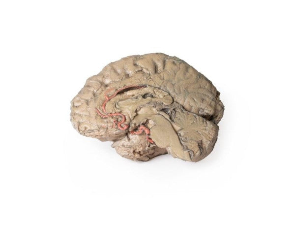Brain 3D Printed Anatomy Model
