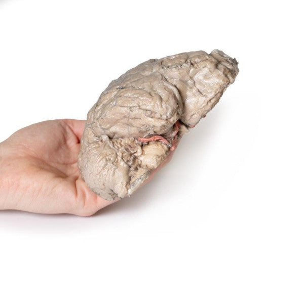 Brain 3D Printed Anatomy Model