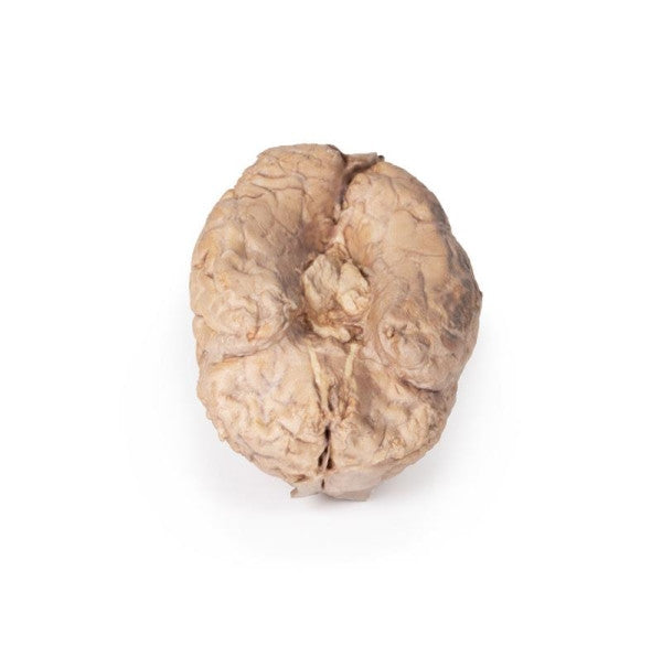 Brain 3D Printed Anatomy Model