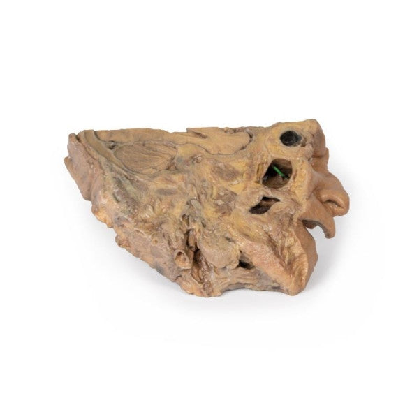 Sinus 3D Printed Anatomy Model