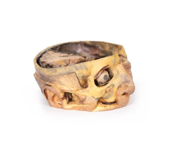 Head and Neck 3D Printed Anatomy Model