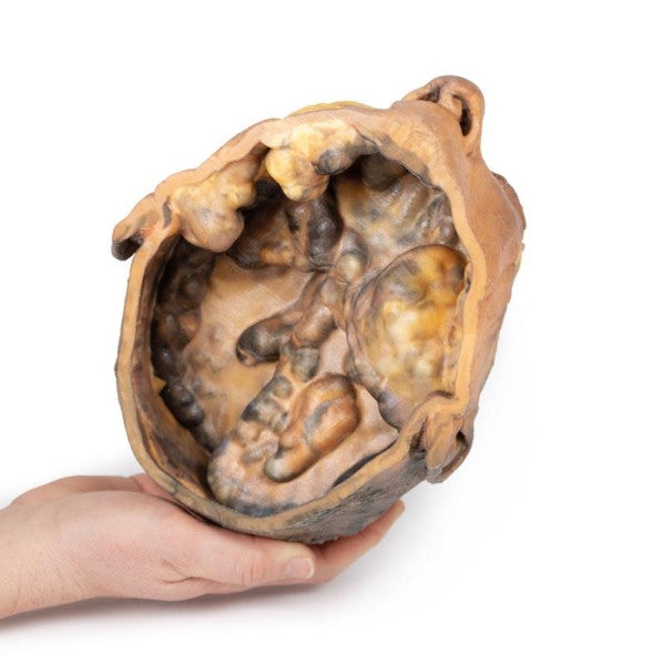 Head and Neck 3D Printed Anatomy Model