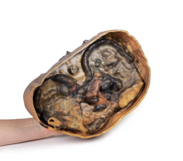 Thorax Anatomy 3D Printed Anatomy Model