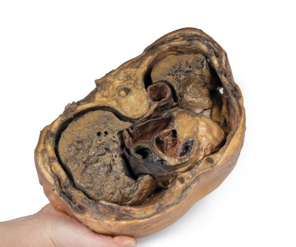 Thorax Anatomy 3D Printed Anatomy Model