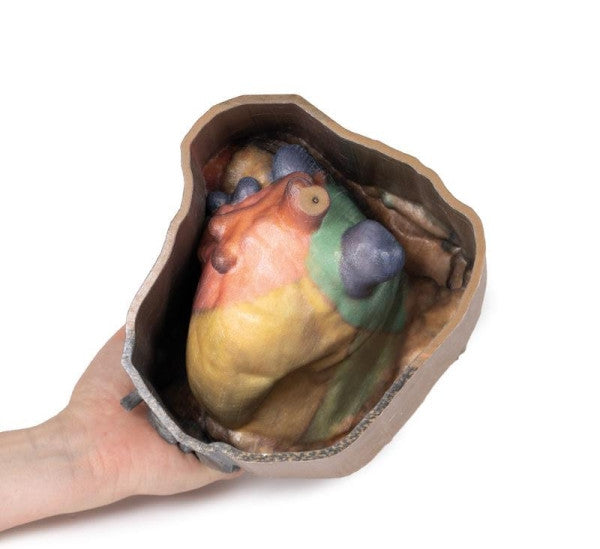 Posterior Aspect of the Pericardial Space 3D Printed Anatomy Model