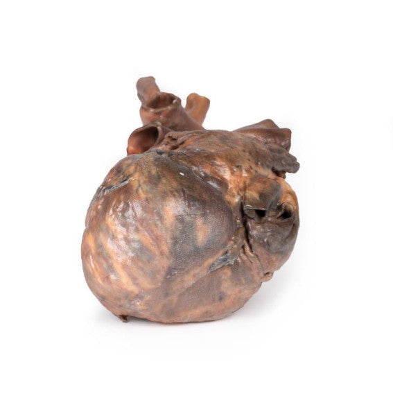 Inferior aspect of the heart 3D printed anatomy model
