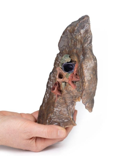 Lung 3D Printed Anatomy Model