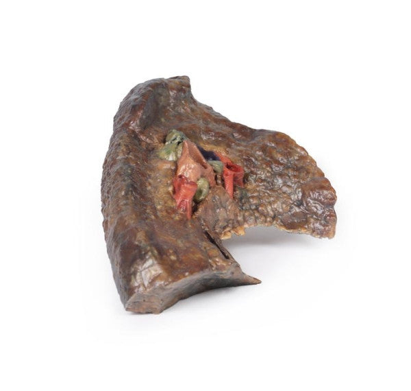 Lung 3D Printed Anatomy Model