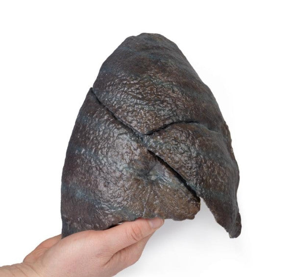 Lung 3D Printed Anatomy Model