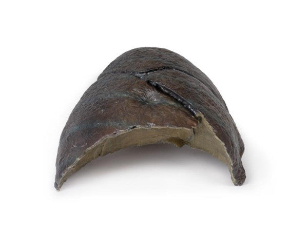 Lung 3D Printed Anatomy Model