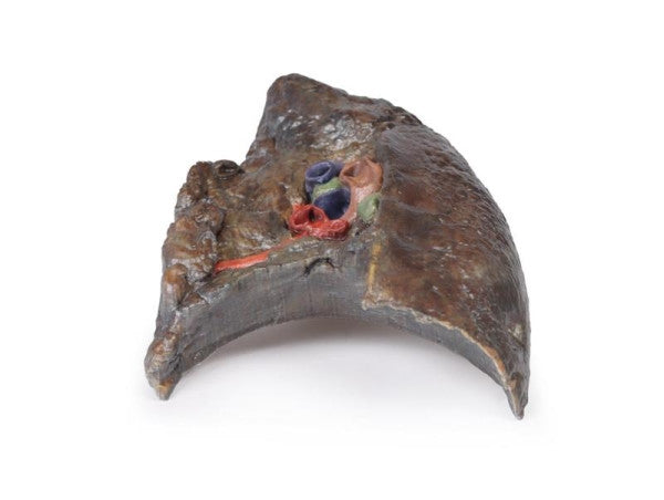 Lung 3D Printed Anatomy Model