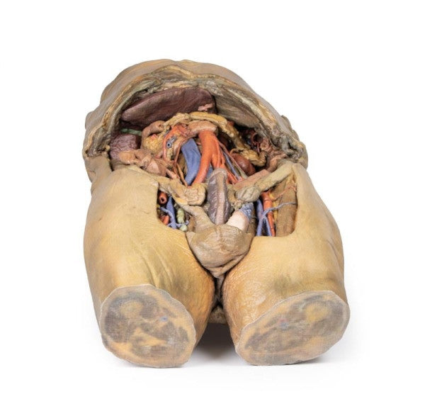 Abdomen 3D Printed Anatomy Model