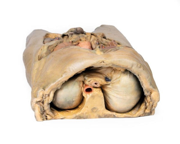 Superior View of the Abdomen with Bilateral Hernia Model