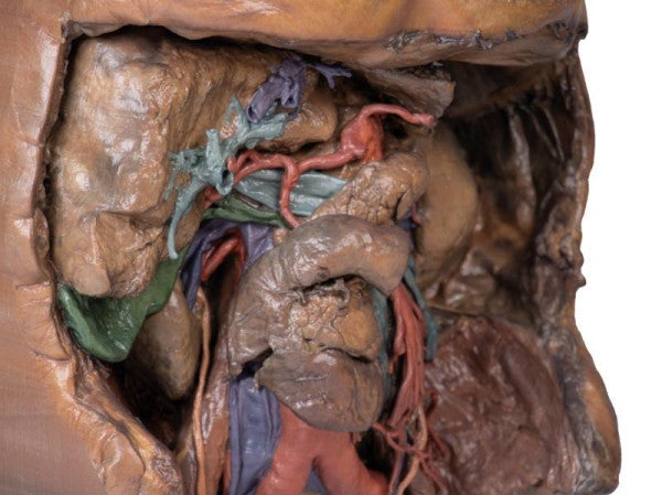Abdomen 3D Printed Anatomy Model