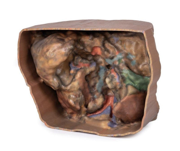 Posterior aspect of the abdomen vasculature model