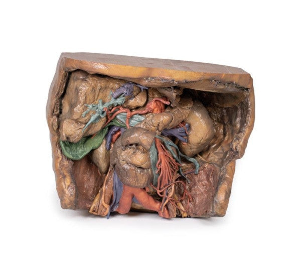 Abdomen 3D Printed Anatomy Model
