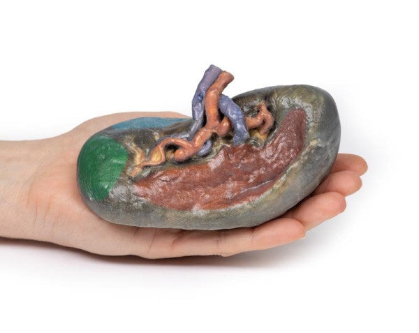 Spleen 3D Printed Anatomy Model