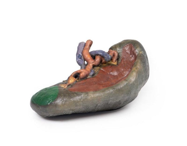 Spleen 3D Printed Anatomy Model
