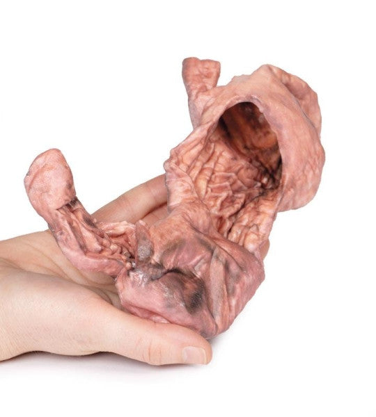 Stomach 3D Printed Anatomy Model