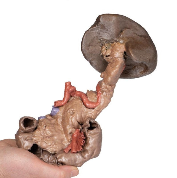 Spleen 3D Printed Anatomy Model