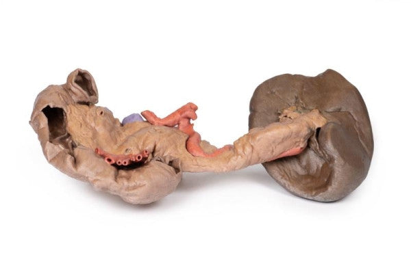 Spleen 3D Printed Anatomy Model