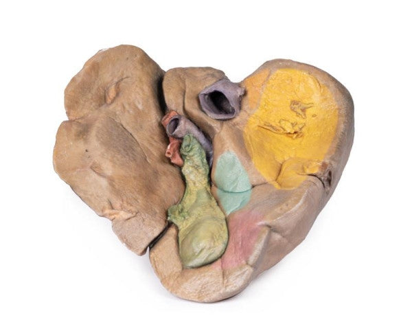 Liver 3D Printed Anatomy Model