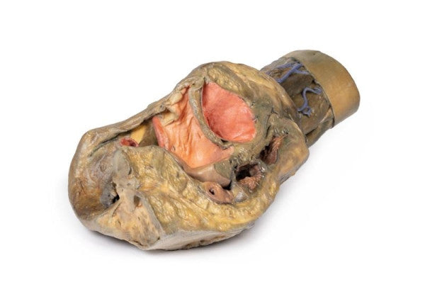 Female Pelvis 3D Printed Anatomy Model