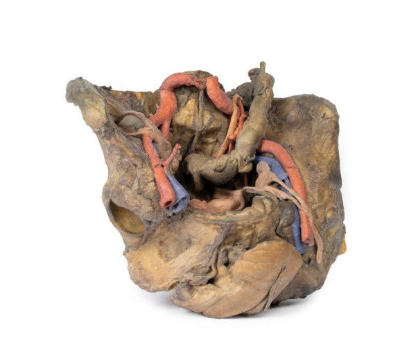 Female Pelvis 3D Printed Anatomy Model