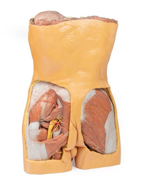 Body Wall 3D Printed Anatomy Model