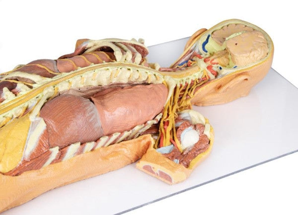 Superior Half of the Nervous System Dissection (Posterior View) 3D Printed Anatomy Model