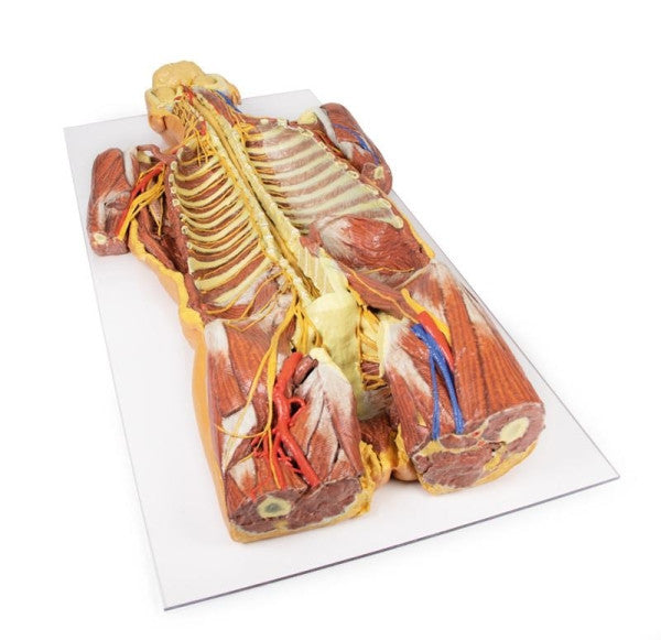 Body Wall 3D Printed Anatomy Model