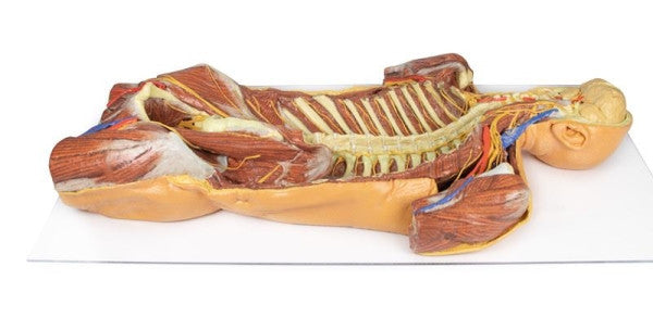 Body Wall 3D Printed Anatomy Model