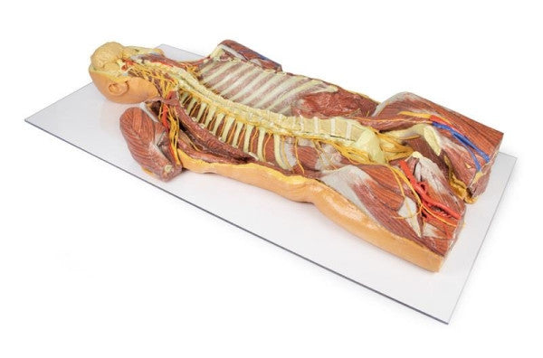 Body Wall 3D Printed Anatomy Model