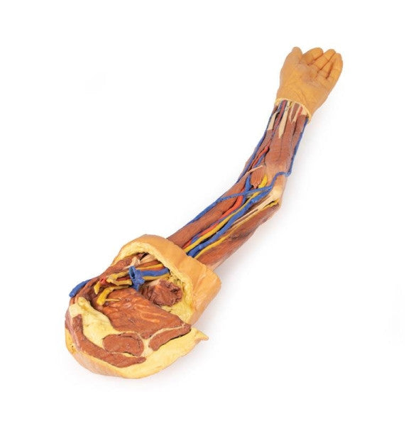 Upper Limb 3D Printed Anatomy Model