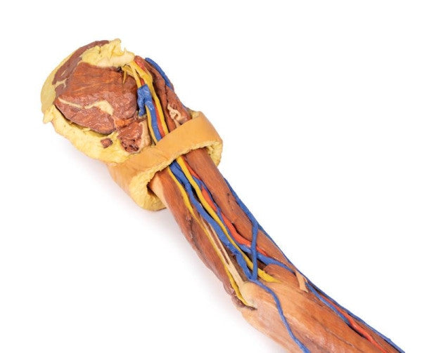 Upper Limb 3D Printed Anatomy Model
