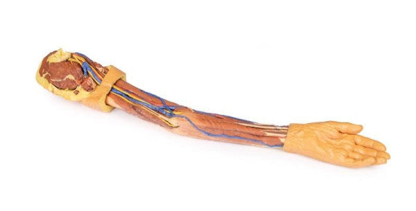 Upper Limb 3D Printed Anatomy Model