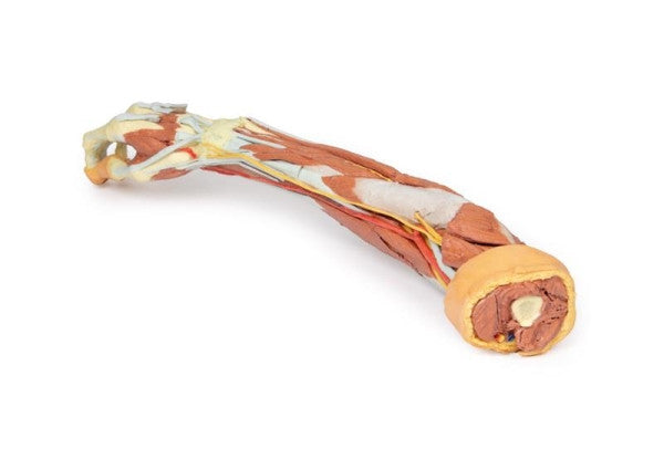 Upper Limb 3D Printed Anatomy Model