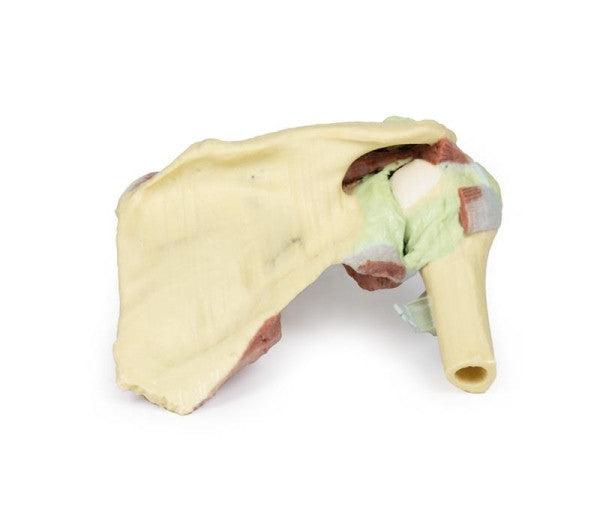 Posterior Aspect of the Shoulder (Deep Dissection of a Right Shoulder Girdle, Preserving a Complete Scapula, Lateral Clavicle, and Proximal Humerus) Model