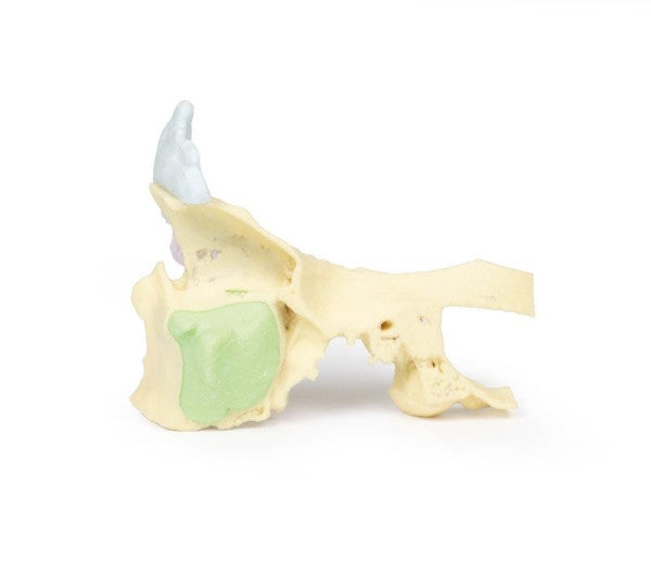 Sinus 3D Printed Anatomy Model