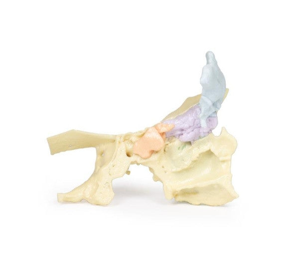 Sinus 3D Printed Anatomy Model