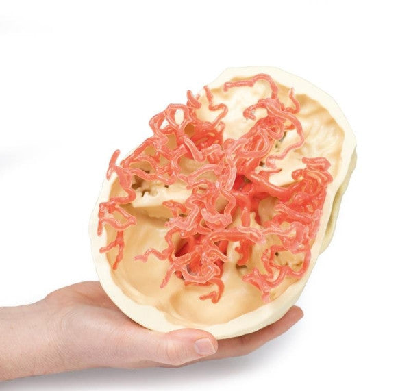 Arterial Circulation 3D Printed Anatomy Model