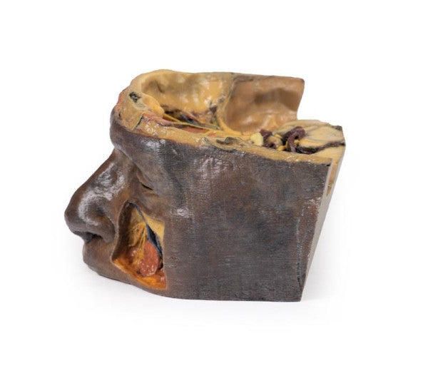 Orbit 3D Printed Anatomy Model