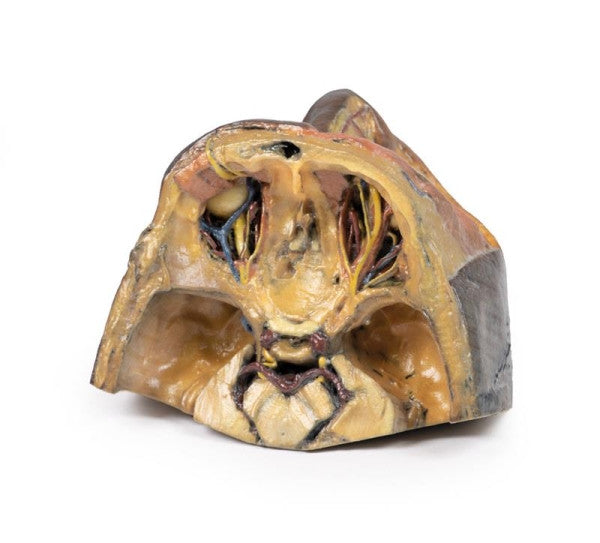 Orbit 3D Printed Anatomy Model