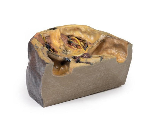 Orbit 3D Printed Anatomy Model